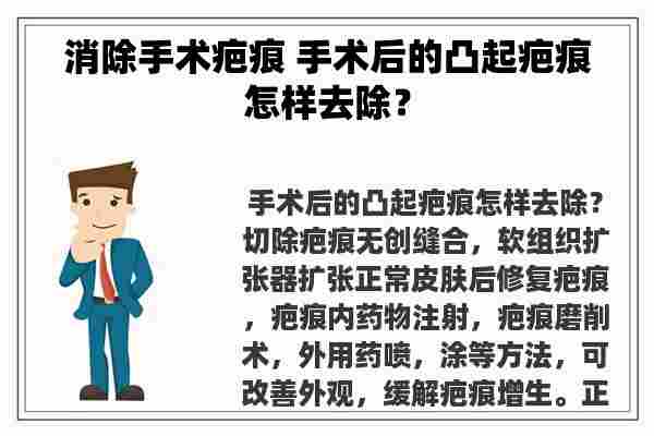 消除手术疤痕 手术后的凸起疤痕怎样去除？